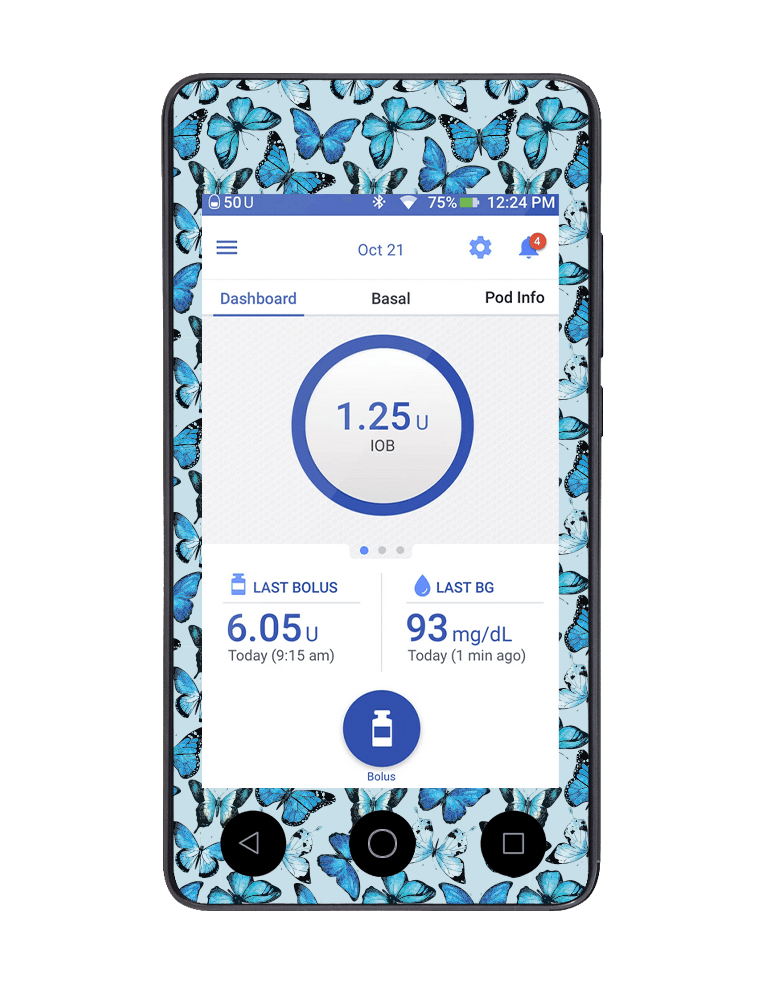 Omnipod DASH Cover (Butterfly Blue) - The Useless Pancreas