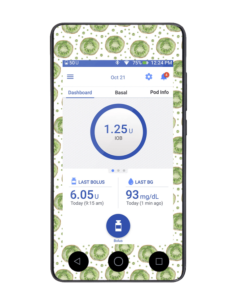 Omnipod DASH Cover (Kiwi Life) - The Useless Pancreas